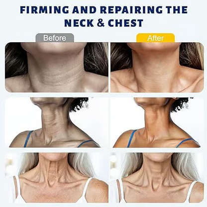Reduces Wrinkles and Double Chin,Five Rollers for All Around Massage,Neck Firming Cream