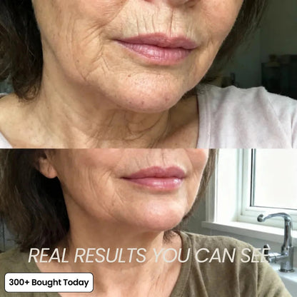 Buy 1 Get 1 Free💋Korean Pink Collagen Volume Multi Balm
